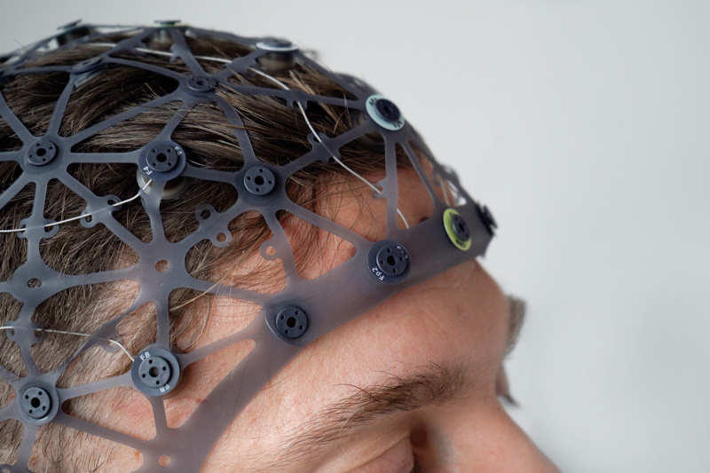 Kako dobro delujejo vaši možgani?