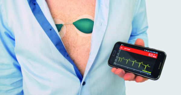 SAVVY ECG for early detection of heart arrhythmia